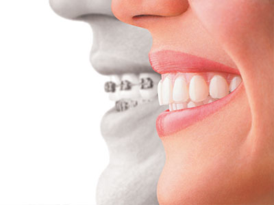 Abercorn Dental | Veneers, Preventative Program and Oral Exams