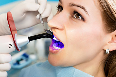 Abercorn Dental | Dental Sealants, Toothaches and Dental Bridges