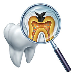 Abercorn Dental | Preventative Program, Veneers and Cosmetic Gum Recontouring