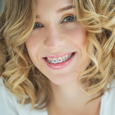 Abercorn Dental | Preventative Program, Dental Sealants and Dental Bonding